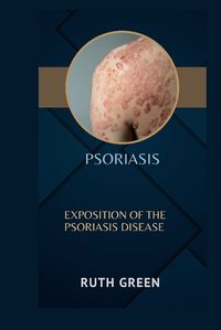 Cover image for Psoriasis