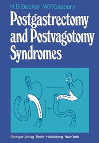 Cover image for Postgastrectomy and Postvagotomy Syndromes