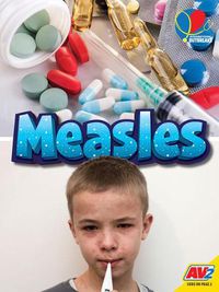 Cover image for Measles