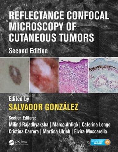 Cover image for Reflectance Confocal Microscopy of Cutaneous Tumors