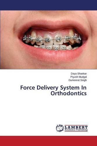 Cover image for Force Delivery System In Orthodontics