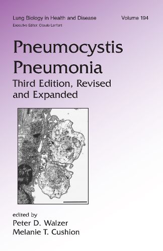 Cover image for Pneumocystis Pneumonia