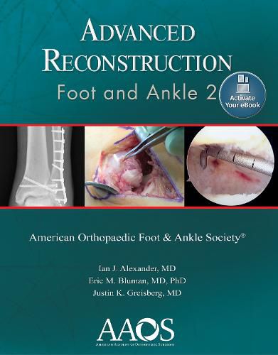 Cover image for Advanced Reconstruction: Foot and Ankle 2: Print + Ebook