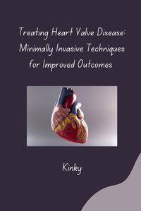 Cover image for Treating Heart Valve Disease