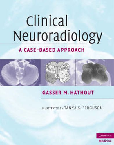 Cover image for Clinical Neuroradiology: A Case-Based Approach