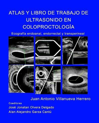 Atlas y Libro de Trabajo de Ultrasonido en Coloproctologia