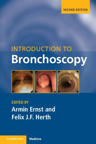 Cover image for Introduction to Bronchoscopy