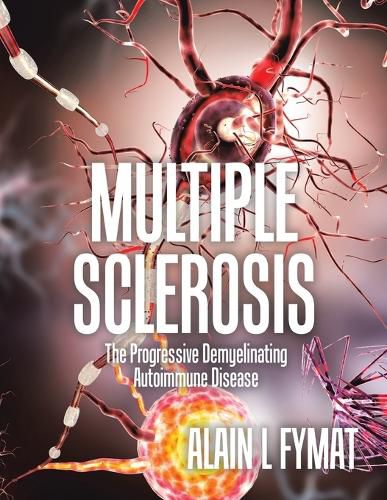 Cover image for Multiple Sclerosis