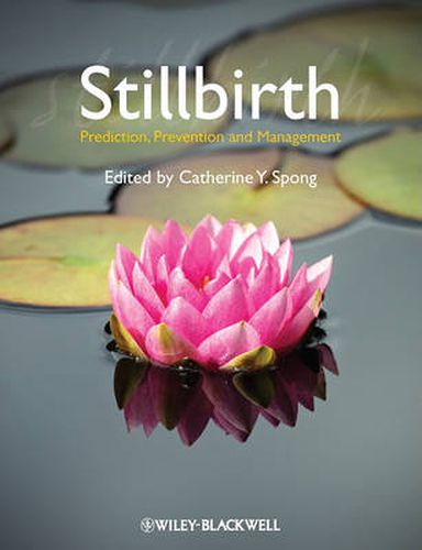 Cover image for Stillbirth: Prediction, Prevention and Management