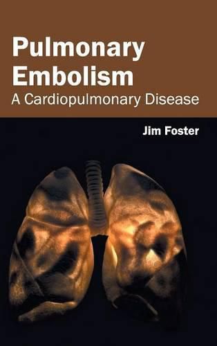 Cover image for Pulmonary Embolism: A Cardiopulmonary Disease