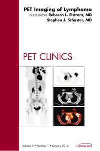 Cover image for PET Imaging of Lymphoma, An Issue of PET Clinics