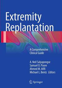 Cover image for Extremity Replantation: A Comprehensive Clinical Guide