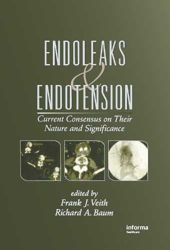 Cover image for Endoleaks and Endotension: Current Consensus on Their Nature and Significance