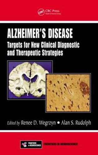 Cover image for Alzheimer's Disease: Targets for New Clinical Diagnostic and Therapeutic Strategies