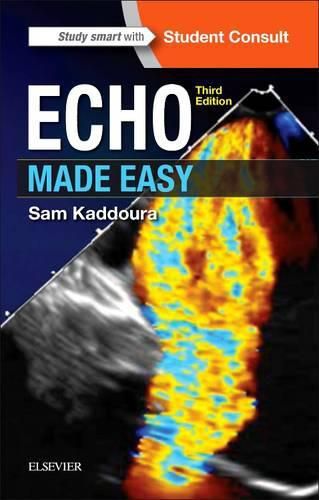 Cover image for Echo Made Easy