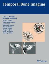 Cover image for Temporal Bone Imaging