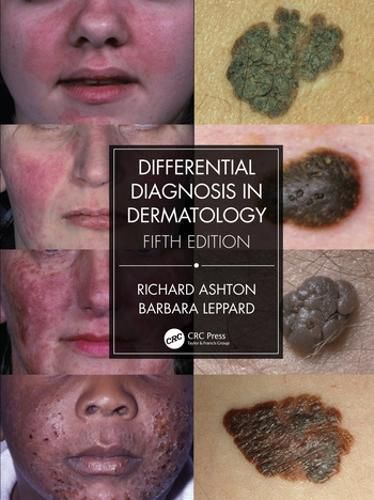 Cover image for Differential Diagnosis in Dermatology