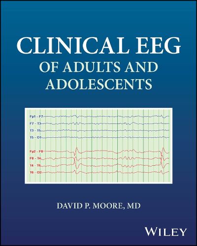 Cover image for Clinical EEG of Adults and Adolescents