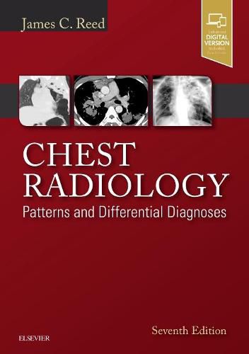 Cover image for Chest Radiology: Patterns and Differential Diagnoses