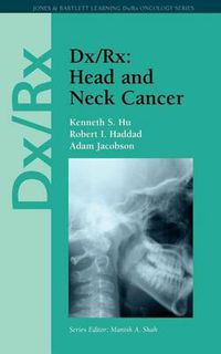 Cover image for Dx/Rx: Head and Neck Cancer: Head and Neck Cancer