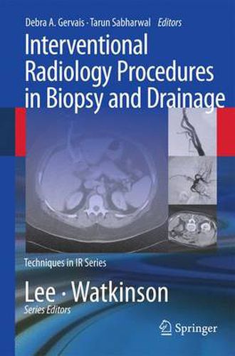 Cover image for Interventional Radiology Procedures in Biopsy and Drainage