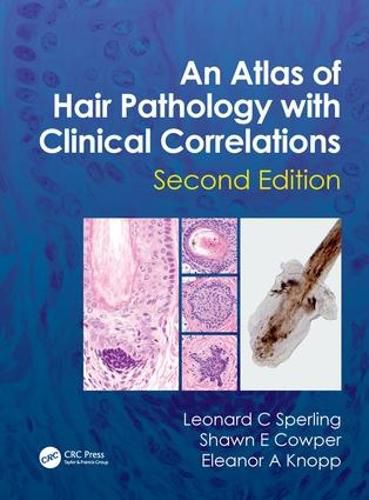 Cover image for An Atlas of Hair Pathology with Clinical Correlations