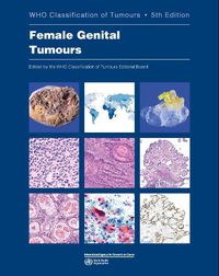 Cover image for WHO classification of female genital tumours