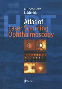 Cover image for Atlas of Laser Scanning Ophthalmoscopy