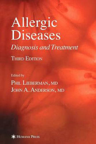 Cover image for Allergic Diseases: Diagnosis and Treatment