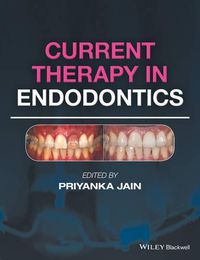 Cover image for Current Therapy in Endodontics