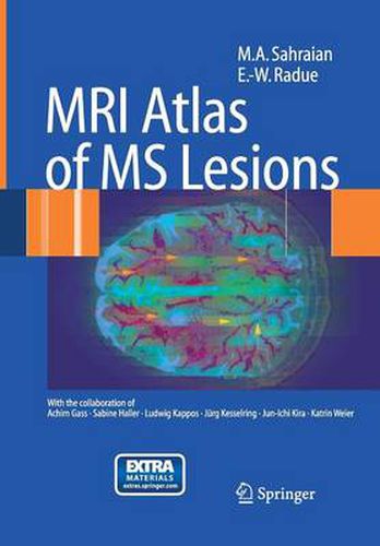 Cover image for MRI Atlas of MS Lesions