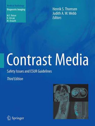 Cover image for Contrast Media: Safety Issues and ESUR Guidelines