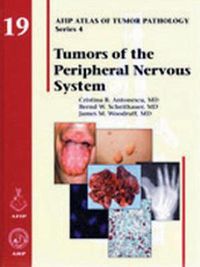 Cover image for Tumors of the Peripheral Nervous System