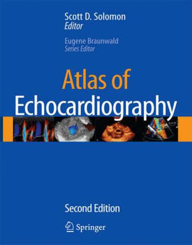 Cover image for Atlas of Echocardiography