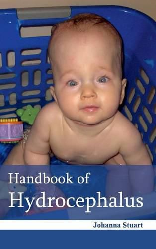 Cover image for Handbook of Hydrocephalus
