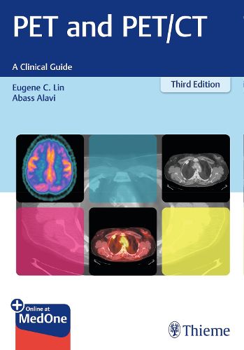 Cover image for PET and PET/CT: A Clinical Guide