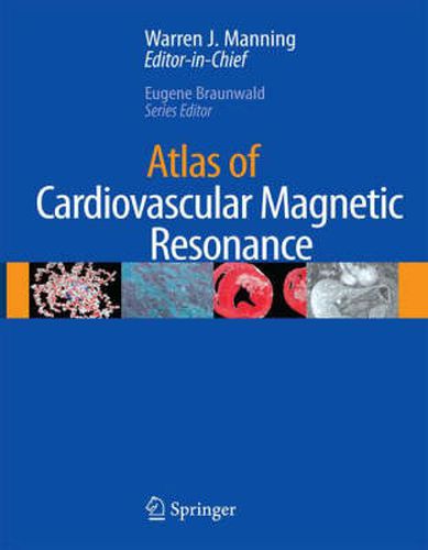Cover image for Atlas of Cardiovascular Magnetic Resonance