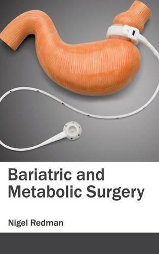 Cover image for Bariatric and Metabolic Surgery