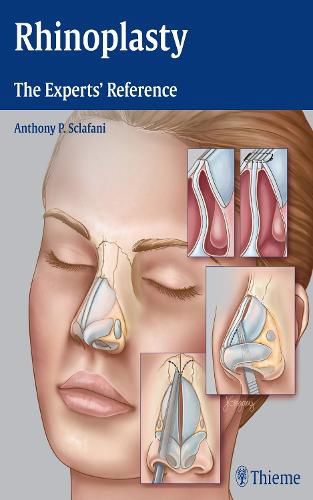 Cover image for Rhinoplasty: The Experts' Reference