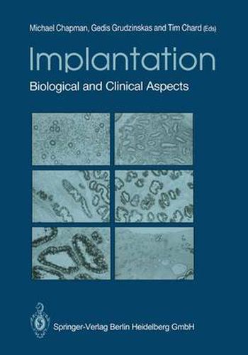 Cover image for Implantation: Biological and Clinical Aspects