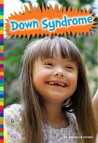 Cover image for Down Syndrome