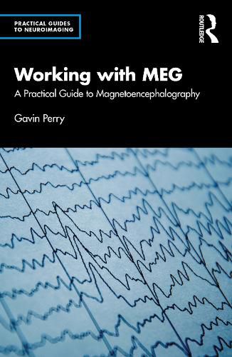 Cover image for Working with MEG: A Practical Guide to Magnetoencephalography