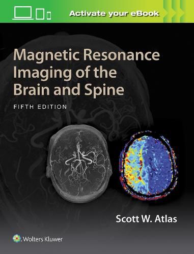 Cover image for Magnetic Resonance Imaging of the Brain and Spine