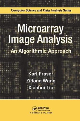 Cover image for Microarray Image Analysis: An Algorithmic Approach