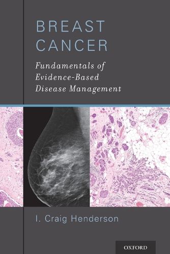 Cover image for Breast Cancer: Fundamentals of Evidence-Based Disease Management