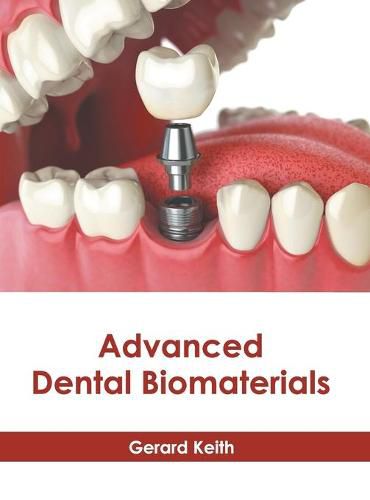 Cover image for Advanced Dental Biomaterials
