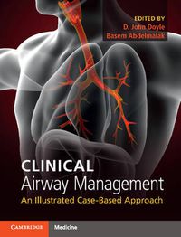 Cover image for Clinical Airway Management: An Illustrated Case-Based Approach