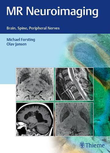 Cover image for MR Neuroimaging: Brain, Spine, Peripheral Nerves