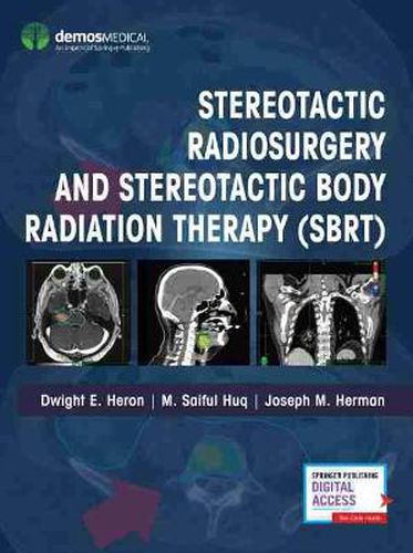 Cover image for Stereotactic Radiosurgery and Stereotactic Body Radiation Therapy (SBRT)