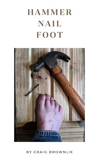 Cover image for Hammer Nail Foot